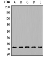 DGUOK / Deoxyguanosine Kinase Antibody - Western blot analysis of DGUOK expression in HepG2 (A); mouse heart (B); mouse kidney (C); rat liver (D); rat brain (E) whole cell lysates.