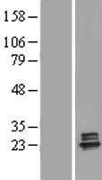 DGUOK / Deoxyguanosine Kinase Protein - Western validation with an anti-DDK antibody * L: Control HEK293 lysate R: Over-expression lysate