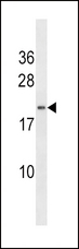 DHAND / HAND2 Antibody - Western blot of anti-HAND2 Antibody in NCI-H460 cell line lysates (35 ug/lane). HAND2(arrow) was detected using the purified antibody.