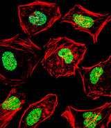DHAND / HAND2 Antibody - Fluorescent confocal image of HeLa cell stained with HAND2 Antibody. HeLa cells were fixed with 4% PFA (20 min), permeabilized with Triton X-100 (0.1%, 10 min), then incubated with HAND2 primary antibody (1:25, 1 h at 37°C). For secondary antibody, Alexa Fluor 488 conjugated donkey anti-rabbit antibody (green) was used (1:400, 50 min at 37°C). Cytoplasmic actin was counterstained with Alexa Fluor 555 (red) conjugated Phalloidin (7units/ml, 1 h at 37°C). Nuclei were counterstained with DAPI (blue) (10 ug/ml, 10 min). HAND2 immunoreactivity is localized to Nucleus significantly.