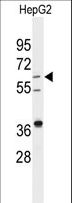 DHCR24 / Seladin-1 Antibody - Western blot of anti-DHCR24 Antibody in HepG2 cell line lysates (35 ug/lane). DHCR24 (arrow) was detected using the purified antibody.