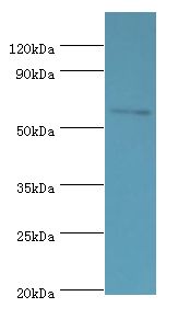 DHCR24 / Seladin-1 Antibody - Western blot. All lanes: DHCR24 antibody at 2 ug/ml+Jurkat whole cell lysate. Secondary antibody: Goat polyclonal to rabbit at 1:10000 dilution. Predicted band size: 60 kDa. Observed band size: 60 kDa.
