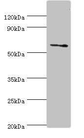 DHCR24 / Seladin-1 Antibody - Western blot All lanes: DHCR24 antibody at 2µg/ml + Jurkat whole cell lysate Secondary Goat polyclonal to rabbit IgG at 1/10000 dilution Predicted band size: 61, 55 kDa Observed band size: 61 kDa