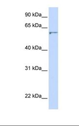 DHCR24 / Seladin-1 Antibody - 721_B cell lysate. Antibody concentration: 1.0 ug/ml. Gel concentration: 12%.  This image was taken for the unconjugated form of this product. Other forms have not been tested.