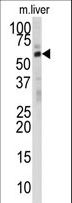 DHCR24 / Seladin-1 Antibody - Western blot of anti-DHCR24 Antibody in mouse liver tissue lysates (35 ug/lane). DHCR24 (arrow) was detected using the purified antibody.