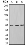 DHCR24 / Seladin-1 Antibody - Western blot analysis of Seladin-1 expression in U87 (A); HT29 (B); PC12 (C) whole cell lysates.