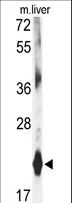 DHFR Antibody - Western blot of DHFR antibody in mouse liver tissue lysates (35 ug/lane). KLF4 (arrow) was detected using the purified antibody.
