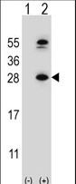 DHFR Antibody - Western blot of DHFR (arrow) using rabbit polyclonal DHFR Antibody. 293 cell lysates (2 ug/lane) either nontransfected (Lane 1) or transiently transfected (Lane 2) with the DHFR gene.