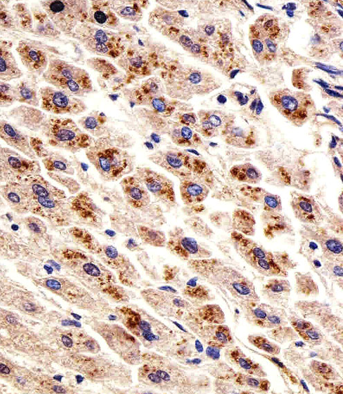 DHFR Antibody - Immunohistochemical of paraffin-embedded H. liver section using DHFR Antibody. Antibody was diluted at 1:25 dilution. A undiluted biotinylated goat polyvalent antibody was used as the secondary, followed by DAB staining.