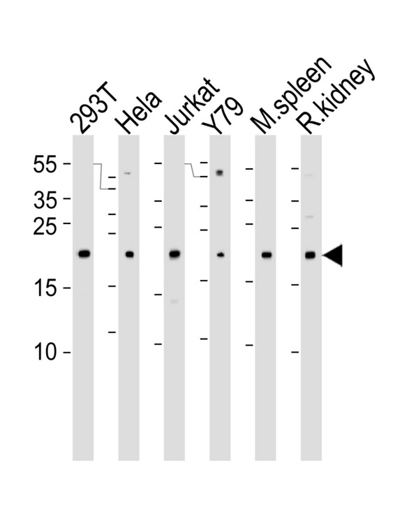 DHFR Antibody - Western blot of lysates from 293T, HeLa, Jurkat, Y79 cell line , mouse spleen and rat kidney tissue lysate (from left to right) with DHFR Antibody. Antibody was diluted at 1:1000 at each lane. A goat anti-rabbit IgG H&L (HRP) at 1:5000 dilution was used as the secondary antibody. Lysates at 35 ug per lane.
