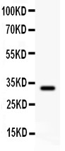 DHFR Antibody - DHFR antibody Western blot. All lanes: Anti DHFR at 0.5 ug/ml. WB: Recombinant Human DHFR Protein 0.5ng. Predicted band size: 32 kD. Observed band size: 32 kD.