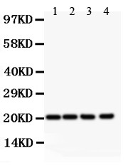 DHFR Antibody - DHFR antibody Western blot. All lanes: Anti DHFR at 0.5 ug/ml. Lane 1: Rat Liver Tissue Lysate at 50 ug. Lane 2: Mouse Liver Tissue Lysate at 50 ug. Lane 3: HepG2 Whole Cell Lysate at 40 ug. Lane 4: Jurkat Whole Cell Lysate at 40 ug. Predicted band size: 21 kD. Observed band size: 21 kD.