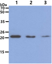 DHFR Antibody - The Cell lysates (40ug) were resolved by SDS-PAGE, transferred to PVDF membrane and probed with anti-human DHFR antibody (1:1000). Proteins were visualized using a goat anti-mouse secondary antibody conjugated to HRP and an ECL detection system. Lane 1. : HeLa cell lysate Lane 2. : Jurkat cell lysate Lane 3 : 293T cell lysate