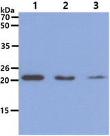 DHFR Antibody - The Cell lysates (40ug) were resolved by SDS-PAGE, transferred to PVDF membrane and probed with anti-human DHFR antibody (1:1000). Proteins were visualized using a goat anti-mouse secondary antibody conjugated to HRP and an ECL detection system. Lane 1. : HeLa cell lysate Lane 2. : Jurkat cell lysate Lane 3 : 293T cell lysate