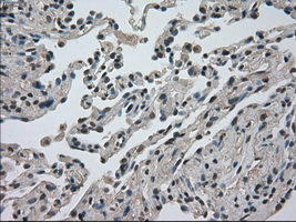 DHFR Antibody - IHC of paraffin-embedded lung tissue using anti-DHFR mouse monoclonal antibody. (Dilution 1:50).