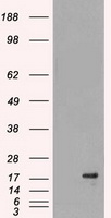 DHFR Antibody - HEK293T cells were transfected with the pCMV6-ENTRY control (Left lane) or pCMV6-ENTRY DHFR (Right lane) cDNA for 48 hrs and lysed. Equivalent amounts of cell lysates (5 ug per lane) were separated by SDS-PAGE and immunoblotted with anti-DHFR.