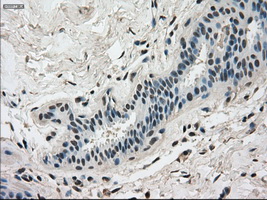 DHFR Antibody - IHC of paraffin-embedded breast tissue using anti-DHFR mouse monoclonal antibody. (Dilution 1:50).