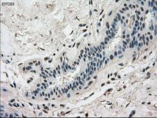 DHFR Antibody - IHC of paraffin-embedded breast tissue using anti-DHFR mouse monoclonal antibody. (Dilution 1:50).