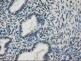 DHFR Antibody - IHC of paraffin-embedded endometrium tissue using anti-DHFR mouse monoclonal antibody. (Dilution 1:50).