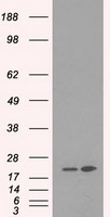 DHFR Antibody - HEK293T cells were transfected with the pCMV6-ENTRY control (Left lane) or pCMV6-ENTRY DHFR (Right lane) cDNA for 48 hrs and lysed. Equivalent amounts of cell lysates (5 ug per lane) were separated by SDS-PAGE and immunoblotted with anti-DHFR.