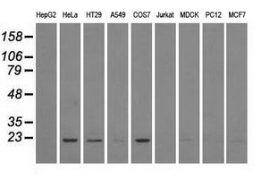 DHFR Antibody - Western blot of extracts (35 ug) from 9 different cell lines by using anti-DHFR monoclonal antibody.