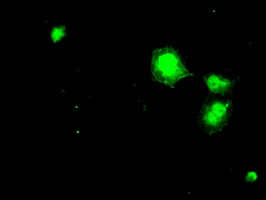 DHFR Antibody - Anti-DHFR mouse monoclonal antibody  immunofluorescent staining of COS7 cells transiently transfected by pCMV6-ENTRY DHFR.