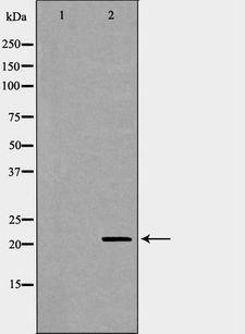 DHFR Antibody - Western blot analysis of HeLa whole cells lysates using DHFR antibody. The lane on the left is treated with the antigen-specific peptide.