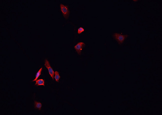 DHFR Antibody - Staining HepG2 cells by IF/ICC. The samples were fixed with PFA and permeabilized in 0.1% Triton X-100, then blocked in 10% serum for 45 min at 25°C. The primary antibody was diluted at 1:200 and incubated with the sample for 1 hour at 37°C. An Alexa Fluor 594 conjugated goat anti-rabbit IgG (H+L) antibody, diluted at 1/600, was used as secondary antibody.