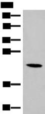 DHFR Antibody - Western blot analysis of 293T cell lysate  using DHFR Polyclonal Antibody at dilution of 1:400