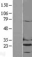 DHFR Protein - Western validation with an anti-DDK antibody * L: Control HEK293 lysate R: Over-expression lysate