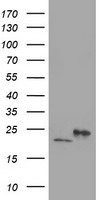 DHFRL1 Antibody - HEK293T cells were transfected with the pCMV6-ENTRY control (Left lane) or pCMV6-ENTRY DHFRL1 (Right lane) cDNA for 48 hrs and lysed. Equivalent amounts of cell lysates (5 ug per lane) were separated by SDS-PAGE and immunoblotted with anti-DHFRL1.