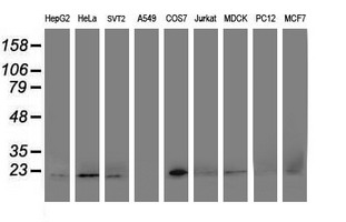 DHFRL1 Antibody - Western blot of extracts (35ug) from 9 different cell lines by using anti-DHFRL1 monoclonal antibody.