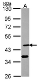 DHH / Desert Hedgehog Antibody - Sample (30 ug of whole cell lysate). A: A431 . 10% SDS PAGE. Desert Hedgehog / DHH antibody diluted at 1:10000.