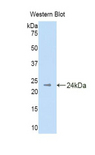 DHH / Desert Hedgehog Antibody - Western blot of recombinant Desert Hedgehog / DHH.  This image was taken for the unconjugated form of this product. Other forms have not been tested.