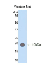 DHH / Desert Hedgehog Antibody - Western blot of recombinant Desert Hedgehog / DHH.  This image was taken for the unconjugated form of this product. Other forms have not been tested.