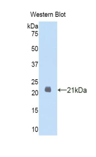 DHH / Desert Hedgehog Antibody - Western blot of recombinant Desert Hedgehog / DHH.  This image was taken for the unconjugated form of this product. Other forms have not been tested.
