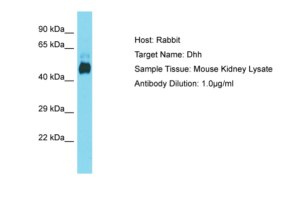 DHH / Desert Hedgehog Antibody -  This image was taken for the unconjugated form of this product. Other forms have not been tested.