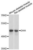 DHH / Desert Hedgehog Antibody - Western blot analysis of extracts of various cell lines, using DHH antibody at 1:3000 dilution. The secondary antibody used was an HRP Goat Anti-Rabbit IgG (H+L) at 1:10000 dilution. Lysates were loaded 25ug per lane and 3% nonfat dry milk in TBST was used for blocking. An ECL Kit was used for detection and the exposure time was 1s.