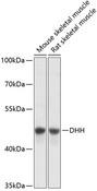 DHH / Desert Hedgehog Antibody - Western blot analysis of extracts of various cell lines using DHH Polyclonal Antibody at dilution of 1:3000.