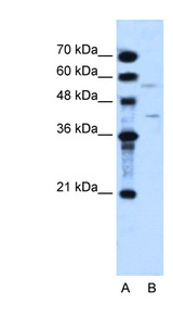 DHODH Antibody - DHODH antibody ARP41940_T100-NP_001352-DHODH(dihydroorotate dehydrogenase) Antibody Western blot of HepG2 cell lysate.  This image was taken for the unconjugated form of this product. Other forms have not been tested.