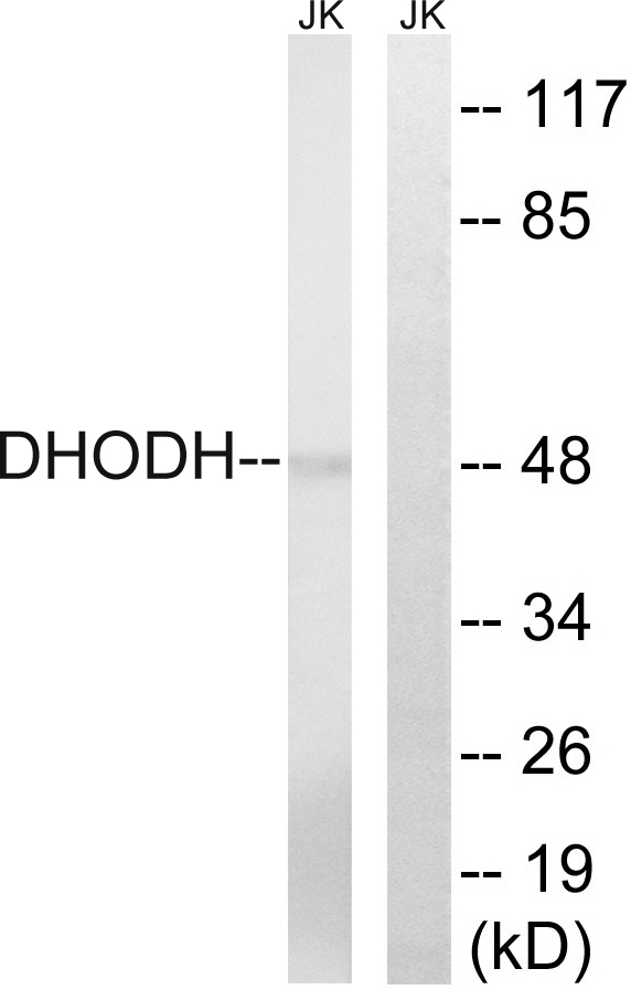 DHODH Antibody - Western blot analysis of lysates from Jurkat cells, using DHODH Antibody. The lane on the right is blocked with the synthesized peptide.