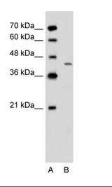 DHODH Antibody - A: Marker, B: Jurkat Cell Lysate.  This image was taken for the unconjugated form of this product. Other forms have not been tested.
