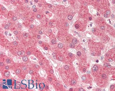 DHODH Antibody - Human Liver: Formalin-Fixed, Paraffin-Embedded (FFPE).  This image was taken for the unconjugated form of this product. Other forms have not been tested.