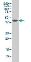 DHODH Antibody - DHODH monoclonal antibody (M01), clone 6E1 Western blot of DHODH expression in MCF-7.