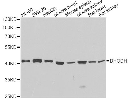 DHODH Antibody - Western blot analysis of extracts of various cell lines, using DHODH antibody at 1:1000 dilution. The secondary antibody used was an HRP Goat Anti-Rabbit IgG (H+L) at 1:10000 dilution. Lysates were loaded 25ug per lane and 3% nonfat dry milk in TBST was used for blocking. An ECL Kit was used for detection and the exposure time was 90s.