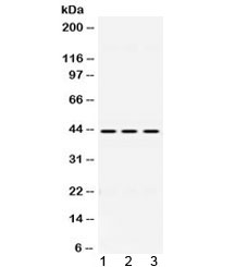 DHODH Antibody - Western blot testing of 1) rat liver, 2) mouse spleen and 3) human HepG2 lysate with DHODH antibody at 0.5ug/ml. Predicted/observed molecular weight ~43 kDa.