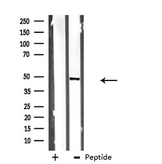 DHODH Antibody - Western blot analysis of extracts of Jurkat cells using DHODH antibody.