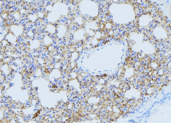 DHODH Antibody - 1:100 staining mouse lung tissue by IHC-P. The sample was formaldehyde fixed and a heat mediated antigen retrieval step in citrate buffer was performed. The sample was then blocked and incubated with the antibody for 1.5 hours at 22°C. An HRP conjugated goat anti-rabbit antibody was used as the secondary.