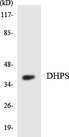 DHPS Antibody - Western blot analysis of the lysates from HUVECcells using DHPS antibody.