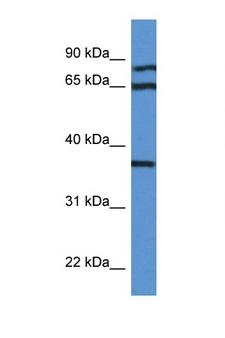 DHPS Antibody - DHPS antibody Western blot of MCF7 Cell lysate. Antibody concentration 1 ug/ml.  This image was taken for the unconjugated form of this product. Other forms have not been tested.